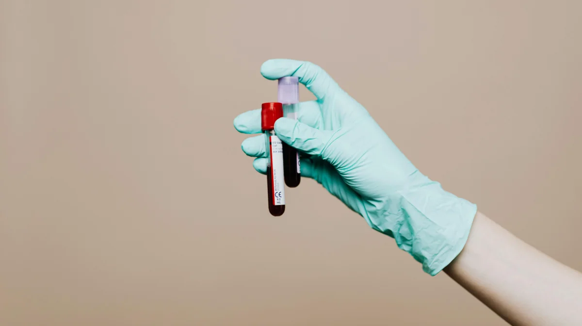 Больше 100 жителей заразились ВИЧ в Акмолинской области