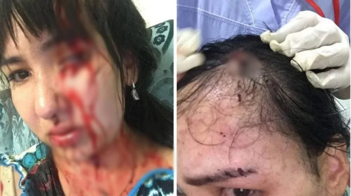 «Облыстық мәслихат депутаты»: Атырау тұрғыны бұрынғы күйеуінен зорлық көргенін айтып, Тоқаевтан көмек сұрады