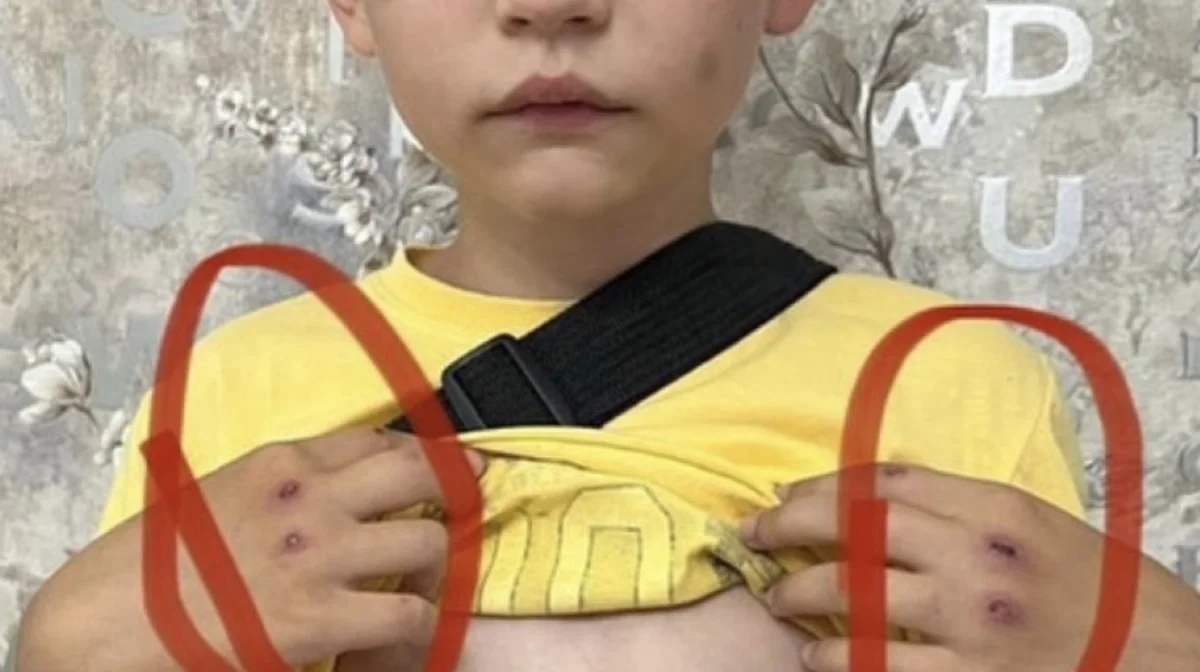 Восьмилетнего мальчика избили в Лисаковске