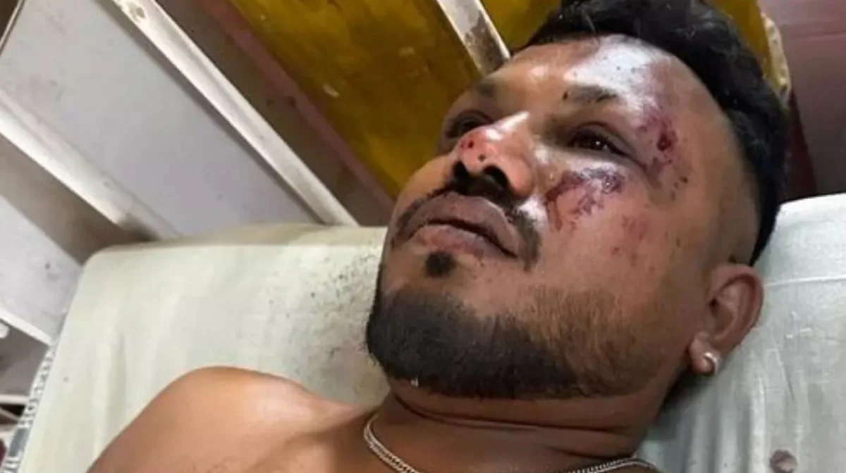 «Есімді жиғанда айналамда мәйіттер жатты»: 242 жолаушысы бар ұшақ апатынан бір адам ғана тірі қалды