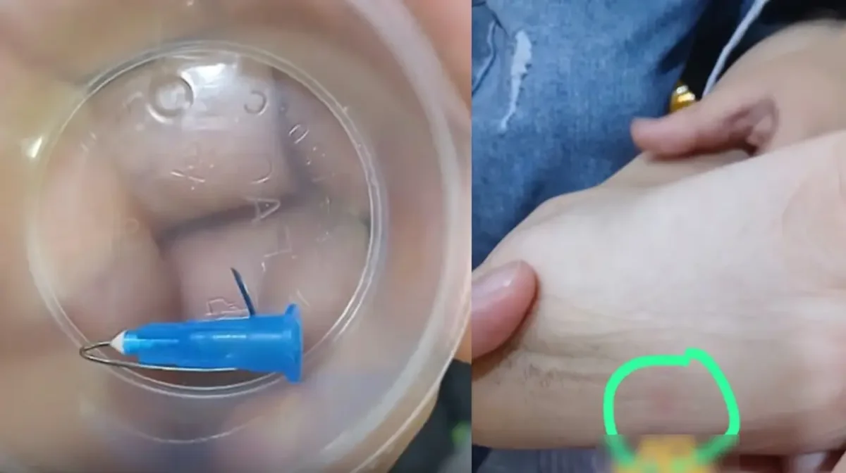 Астанадағы кафеде баланың аяғына медициналық шприц кіріп кеткен