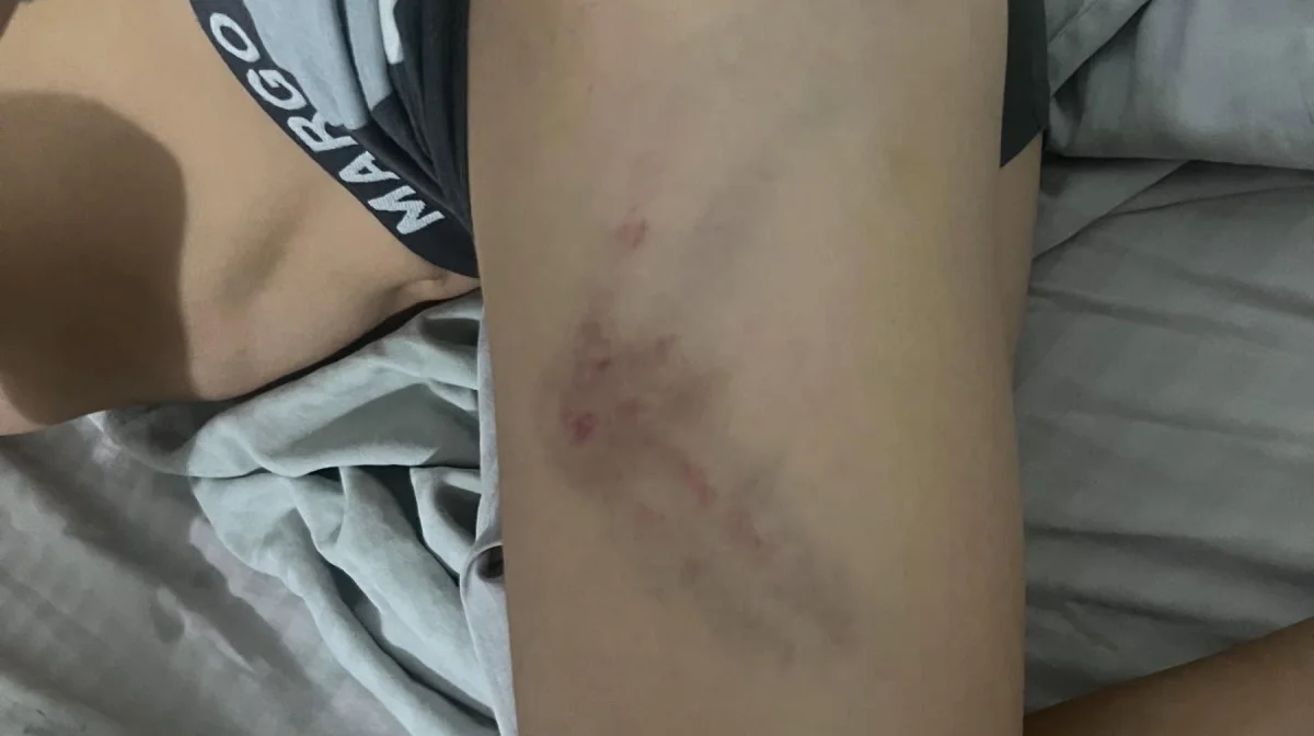 «Ломали пальцы, били, обжигали»: в деле избиения мальчика в Балхаше фигурирует сотрудник «Казахмыса»