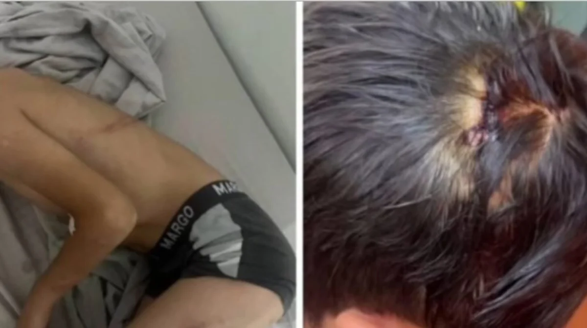 «Он был в аффекте»: новая версия по делу об избиении мальчика в Балхаше