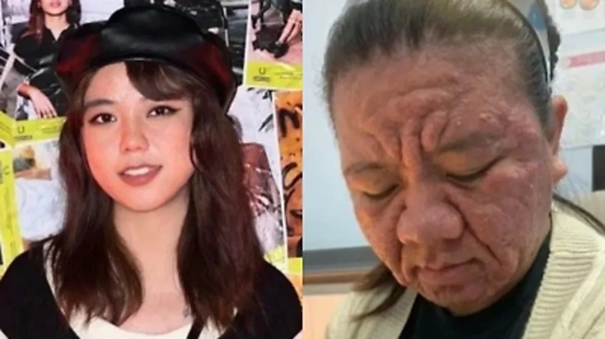 «Бетім күйіп тұрғандай»: 28 жастағы әйел жүктілік кезінде ондаған жылға қартайып кетті