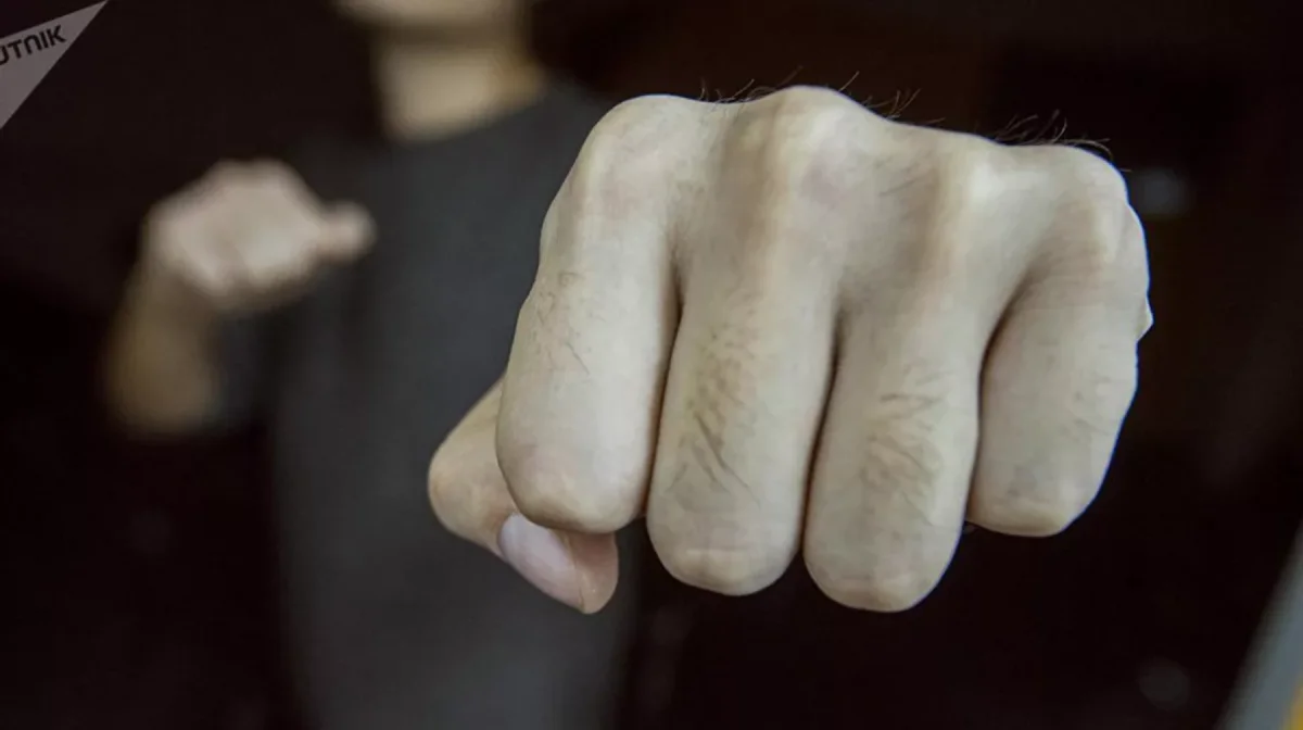 Әйелін дәрігерден қызғанып соққыға жыққан ер адам қамауға алынды