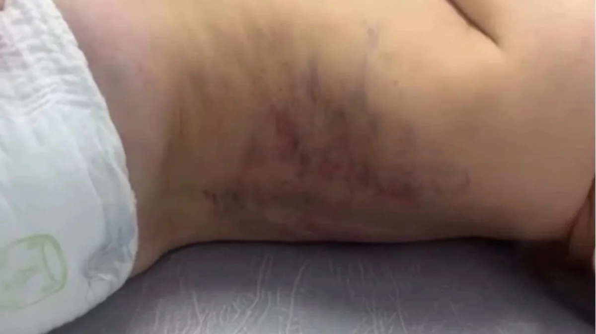 Жетісу облысында әкесі үш жасар баласын көк ала қойдай қылып сабаған