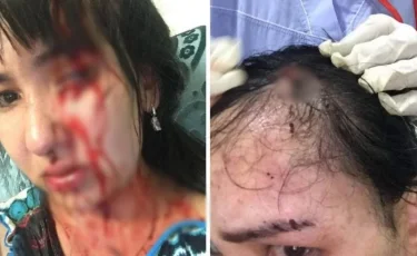 «Облыстық мәслихат депутаты»: Атырау тұрғыны бұрынғы күйеуінен зорлық көргенін айтып, Тоқаевтан көмек сұрады