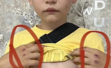 Восьмилетнего мальчика избили в Лисаковске