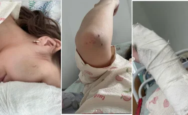 Теміртауда фельдшер әйелді әріптесі ұрып-соққан (ВИДЕО)