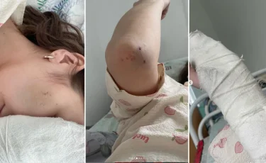 Фельдшера душили и избивали на рабочем месте в Темиртау