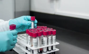 114 адам жұқтырған: Ресейде коронавирустың жаңа түрі жедел тарап жатыр