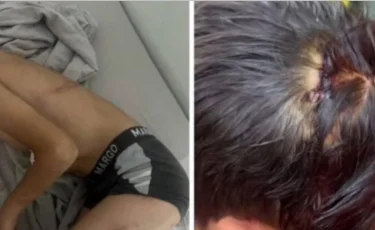 «Он был в аффекте»: новая версия по делу об избиении мальчика в Балхаше