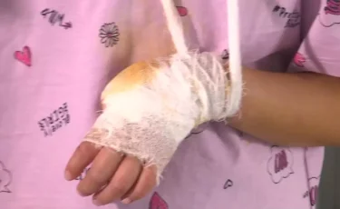 Пятилетней девочке оторвало палец на аттракционах в Актобе