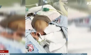 Атырауда дәрігерлер анасы тастап кеткен сәбиге қырқынан шығару рәсімін жасады