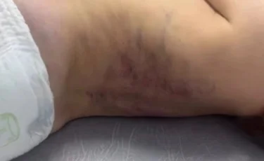 Жетісу облысында әкесі үш жасар баласын көк ала қойдай қылып сабаған