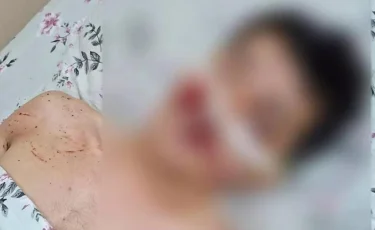 Түркістан облысында жас жігітті бір топ адам өлімші етіп сабап кеткен